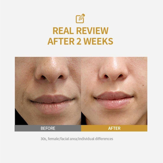 Sungboon Editor Silk Peptide Intensive Lifting Ampoule Αντιγηραντικό Serum Προσώπου με Πεπτίδια για Lifting & Σύσφιξη 35ml