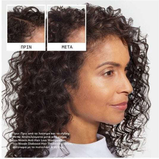 Nioxin Anti-hair Loss Șampon Împotriva Căderii Părului 475ml