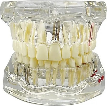 Model Dentar Anatomie Maxilară Dinți