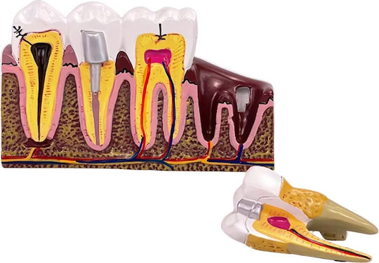 Model Anatomical De Dinți Matriță Model Oral Realist Model Dentar Cabinet Stomatologic Demonstrații Dentare Școală Dentară Bază Dimensiune 16.1 X 12.5 Cm Matriță 13.8 X 8.5 Cm Material Rășină Multicolor