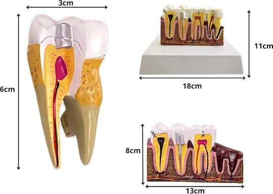 Model Anatomical De Dinți Matriță Model Oral Realist Model Dentar Cabinet Stomatologic Demonstrații Dentare Școală Dentară Bază Dimensiune 16.1 X 12.5 Cm Matriță 13.8 X 8.5 Cm Material Rășină Multicolor