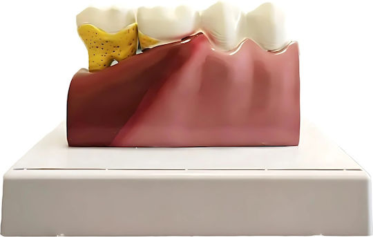 Model Anatomical De Dinți Matriță Model Oral Realist Model Dentar Cabinet Stomatologic Demonstrații Dentare Școală Dentară Bază Dimensiune 16.1 X 12.5 Cm Matriță 13.8 X 8.5 Cm Material Rășină Multicolor