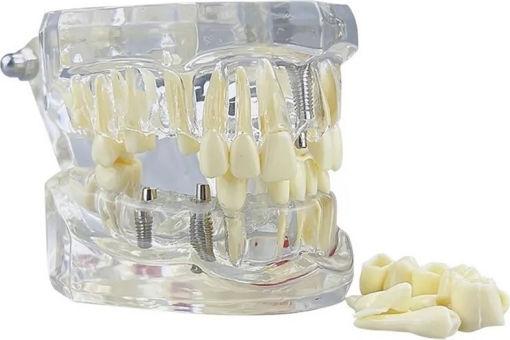 Model Dentar Anatomie Maxilară Dinți