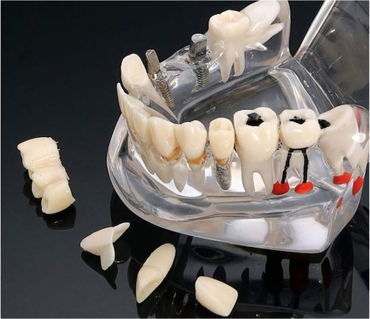 Model Dentar Anatomie Maxilară Dinți