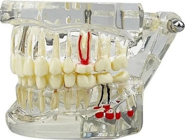 Model Dentar Anatomie Maxilară Dinți