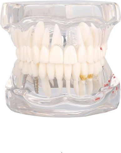 Model Dentar Anatomie Maxilară Dinți