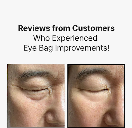 Sungboon Editor Silk Peptide EGF Κρέμα Ματιών για Ενυδάτωση & Μαύροι Κύκλοι 30ml