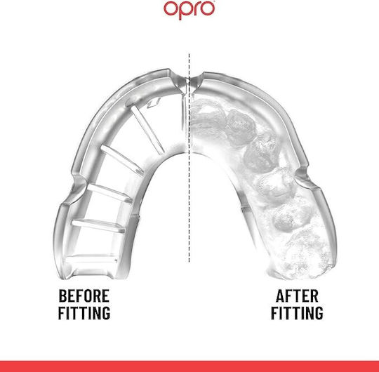 Proteza Dentară Pentru Copii Opro Silver Edition V2 Self Fit Transparentă