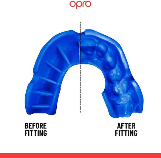 Opro Silver Защитна устна гарнитура Старши Бяла