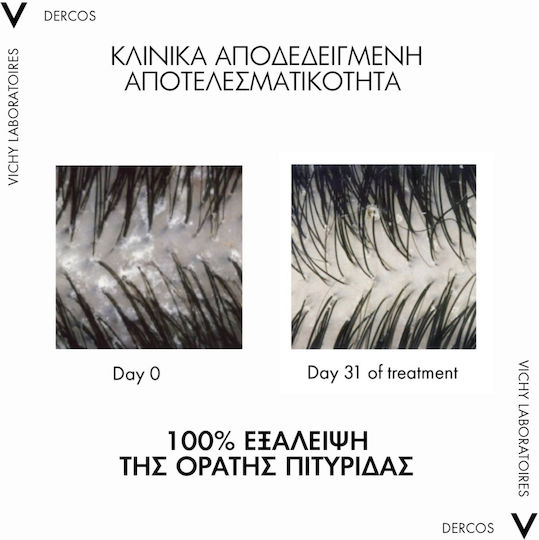 Vichy Dercos Anti Dandruff DS 2в1 Шампоан за Чувствителен Скалп против Пърхот за Всички Типове Коса 200ml
