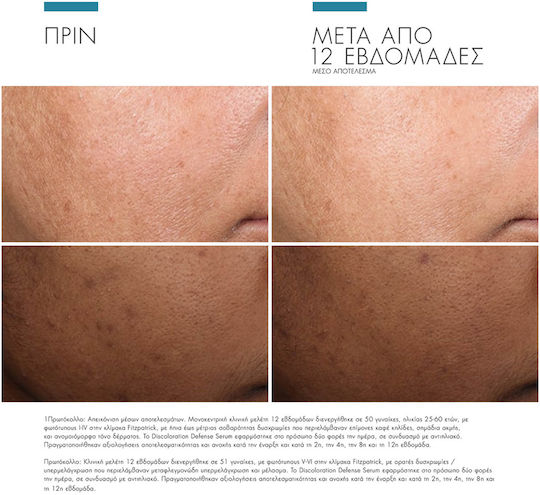 SkinCeuticals Discoloration Defense Anti-aging Serum Face with Vitamin C & Niacinamide 30ml