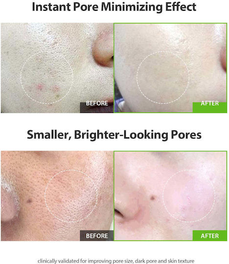 Sungboon Editor Green Tomato Pore Lifting Ampoule+ Moisturizing Ampoule Face Serum with Niacinamide & Hyaluronic Acid for Brightening & Nourishing 40ml