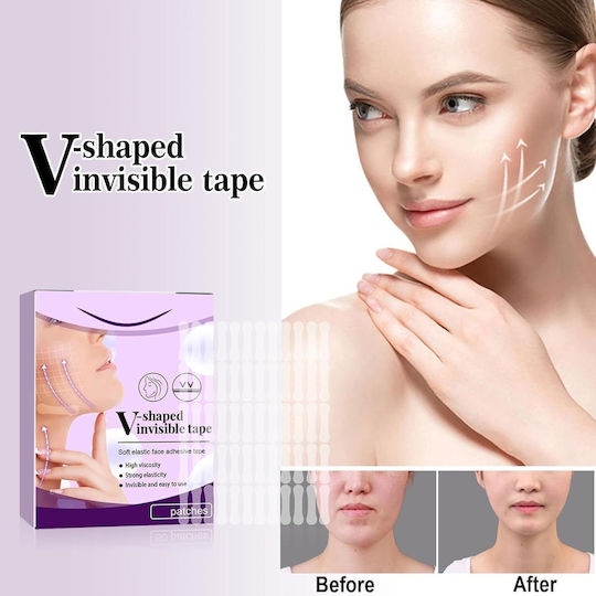 Set V-Shape 60 Stück x 15g