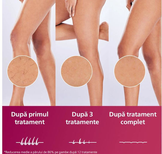 Philips Lumea IPL Series 7000 Αποτριχωτική Μηχανή Epilator για Πρόσωπο & Σώμα BRI976/00