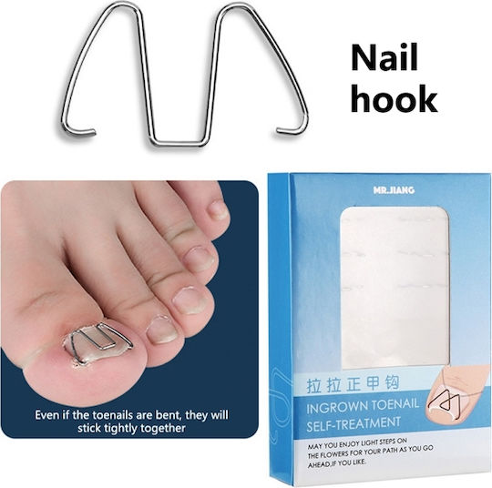 Set 6 Correctors 30 Elastic Bands Ingrown Nails Silver