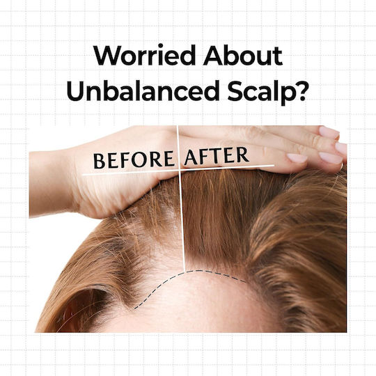 Kundal Scalp Serum Für Die Stärkung 10ml