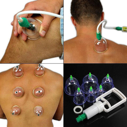 Kl Therapeutic Suction Cup Device 24pcs Pull Out A Vacuum Apparatus 24pcs
