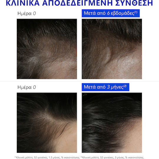 Phyto Phytophanere Ампули За Коса Против Косопад За Жени 12x5ml