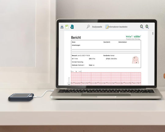 Holter Rhythmus mit Bildschirm