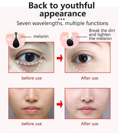 7 Colors 150 LEDs Face Phototherapy Mask 10414