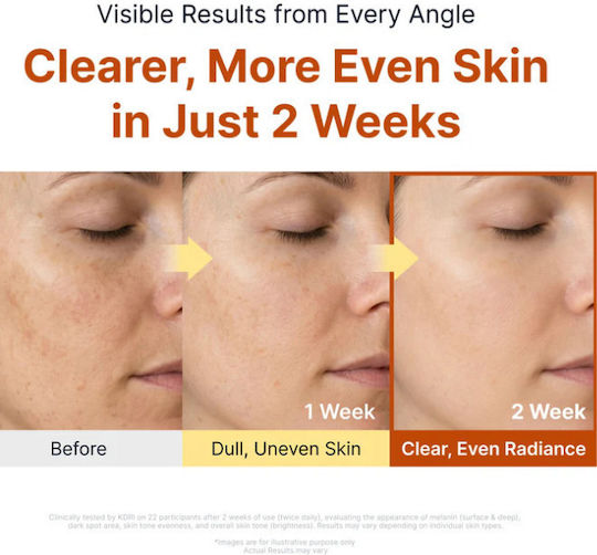 Sungboon Editor Kojic Acid Niacinamid Ampulle Serum Gesicht mit Vitamin C & Niacinamid für Entgiftung & Aufhellung 40ml