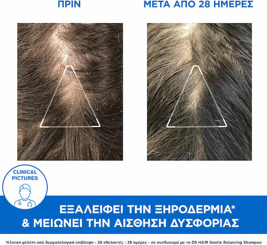 Uriage D.S. Hair Anti-Dandruff Treatment Σαμπουάν κατά της Πιτυρίδας για Λιπαρά Μαλλιά 200ml