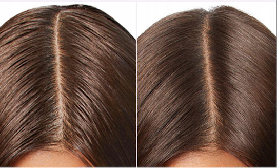 L'Oreal Paris Elseve Hyaluron Pure Σαμπουάν Ενυδάτωσης για Κανονικά Μαλλιά 400ml