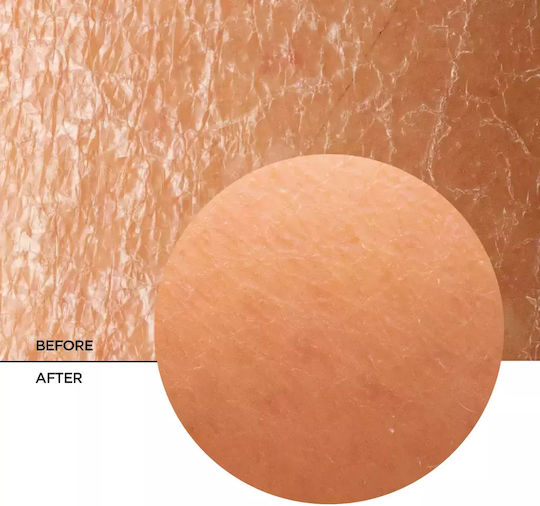 Revox Skintreats Balm Face with Ceramides 50ml