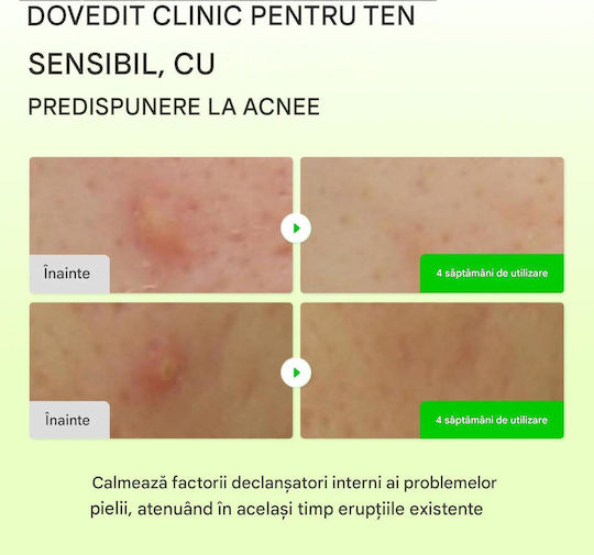 Eqqualberry Dischete Tonifiante pentru Față cu Centella Asiatica, Niacinamidă și Ceai Verde 150ml