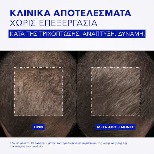 Phyto Phytocyane Ампули срещу Косопад на Коса за Мъже 12x5ml