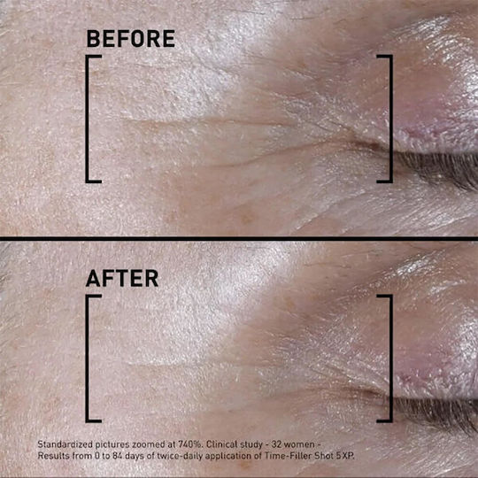 Time-Filler Shot 5 XP Feuchtigkeitsspendend & Anti-Aging Serum Gesicht für Straffung 15ml
