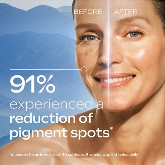 Weleda Anti-Pigment Spot Bright Serum Серум за Лице за Блясък и Пигментни Петна 30ml