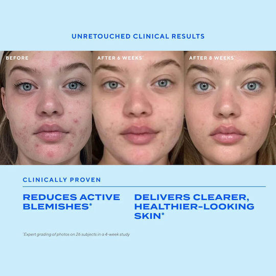Blemish Control Serum Face for Imperfections 30ml