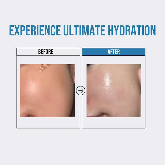 Waterfull Serum Cu Acid Hialuronic 50ml Ser Hidratant Pentru Față