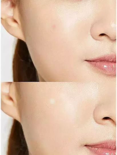 Cosrx Acne Pimple Master Pimple patches 24τμχ