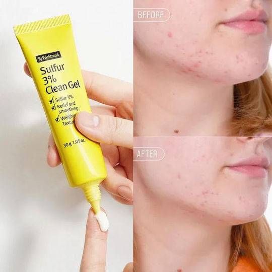 Wishtrend Sulfur 3% Gel Facial Cleanser for Oil Control & Soothing Action 30ml