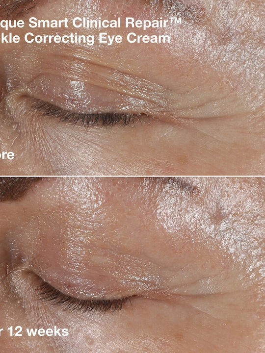 Clinique Smart Clinical Repair Travel Set for Anti-Aging & Firming 4 Pieces