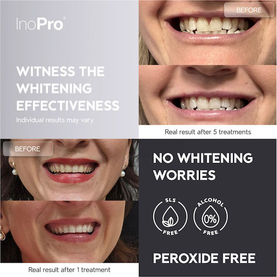 Teeth Whitening Strips, ADVANCED Peroxide-Free, 14 Treatments - 28 Pieces