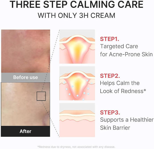 Hypochlorous 3H Relief Redness-Reducing Face Moisturizing Cream with Hyaluronic Acid & Aloe Vera 50ml