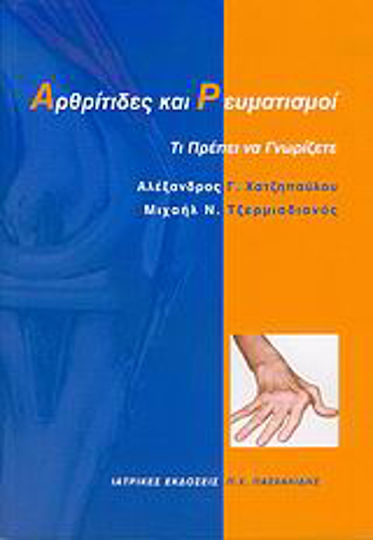 Αρθρίτιδες και ρευματισμοί, What you need to know
