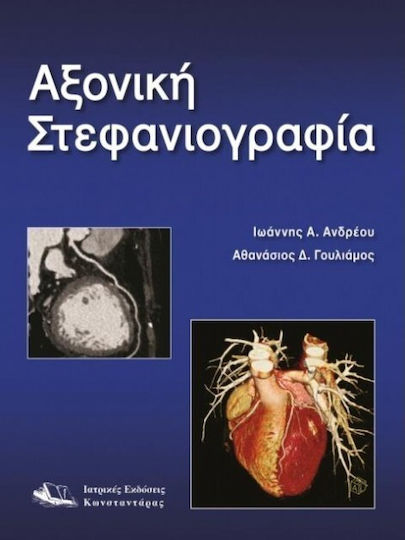 Αξονική στεφανιογραφία Αξονική στεφανιογραφία