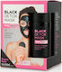 Vican Wise Beauty Detox Charcoal Konjac Spo Μάσκα Ομορφιάς Προσώπου για Καθαρισμό με Ενεργό Άνθρακα 50ml