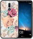 Smartfits Back Cover Plastic Multicolour (Huawei Mate 10 Lite) 2240270696496_22344086356016