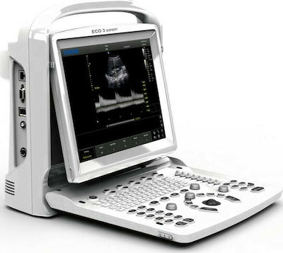 Chison ECO3 Expert Portable Ultrasound Device