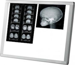 Mimsal AF200 d/c LED Diaphanoscope