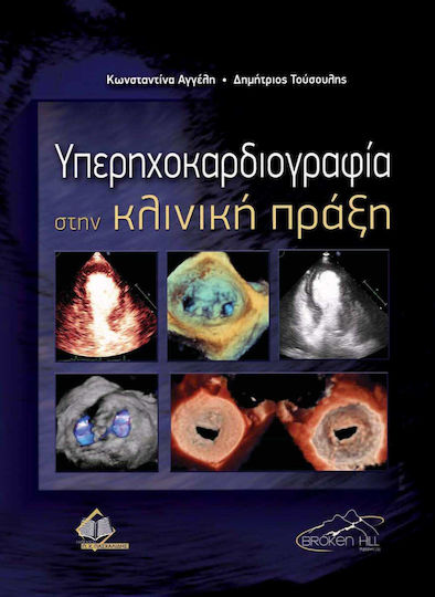 Υπερηχοκαρδιογραφία στην κλινική πράξη Υπερηχοκαρδιογραφία στην κλινική πράξη