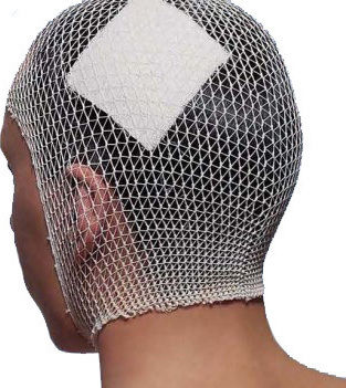Surgifix Cap Bandaj 1.5m