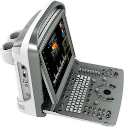 Chison EBit 30 Portable Ultrasound Device