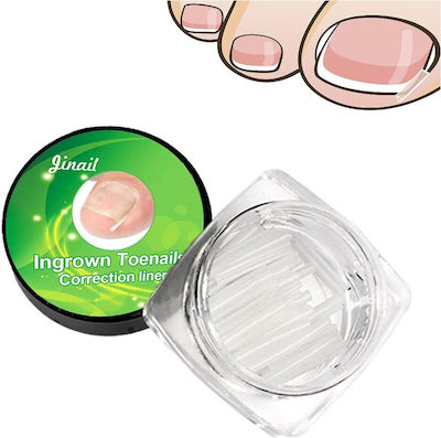 Set of 10 Nail Lifting Correctors & Ingrown Toenail Correctors