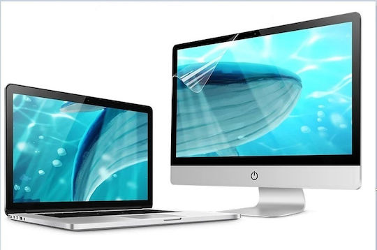 Sunshine Protecția Ecranului Pentru Laptop 14" Antiscratch HD